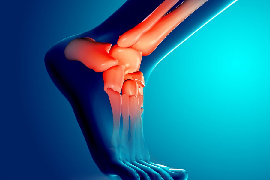 Ayak_Bilegi_Burkulmalari_OG-1