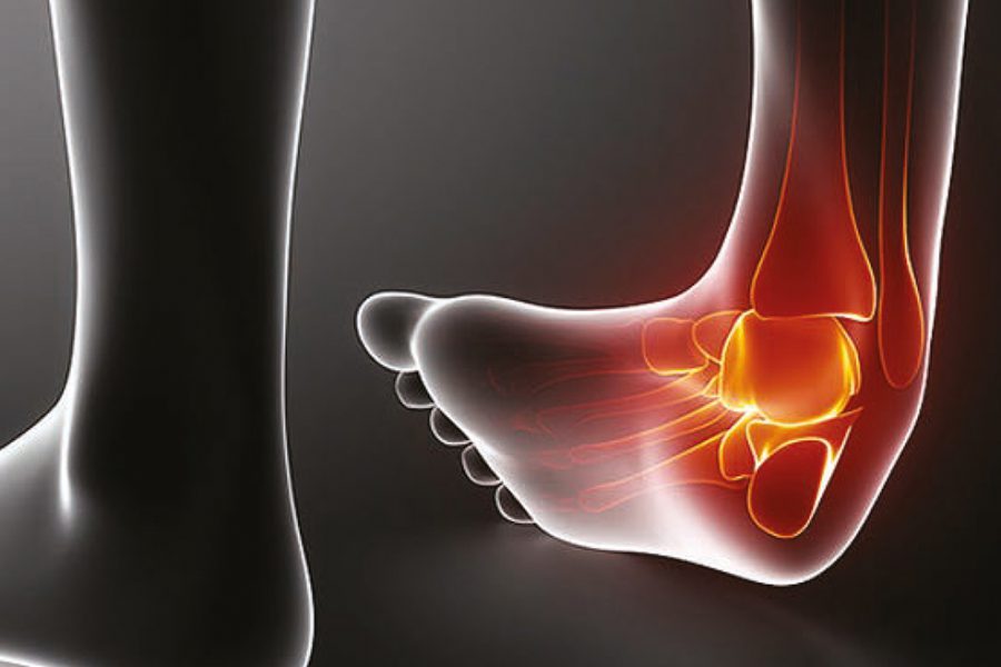 Ayak_Bilegim_Burkuluyor_OGX