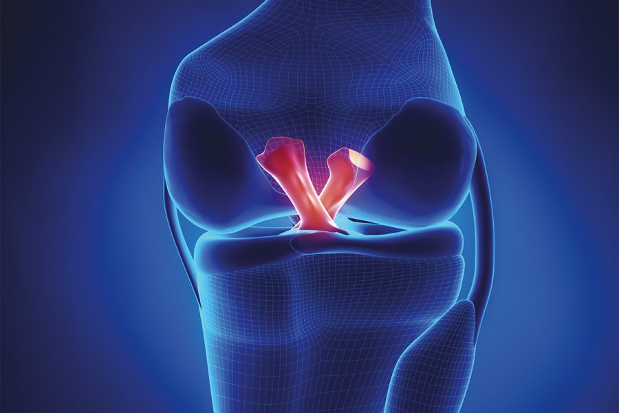 On_Capraz_Bag_Yaralanmalari_OG